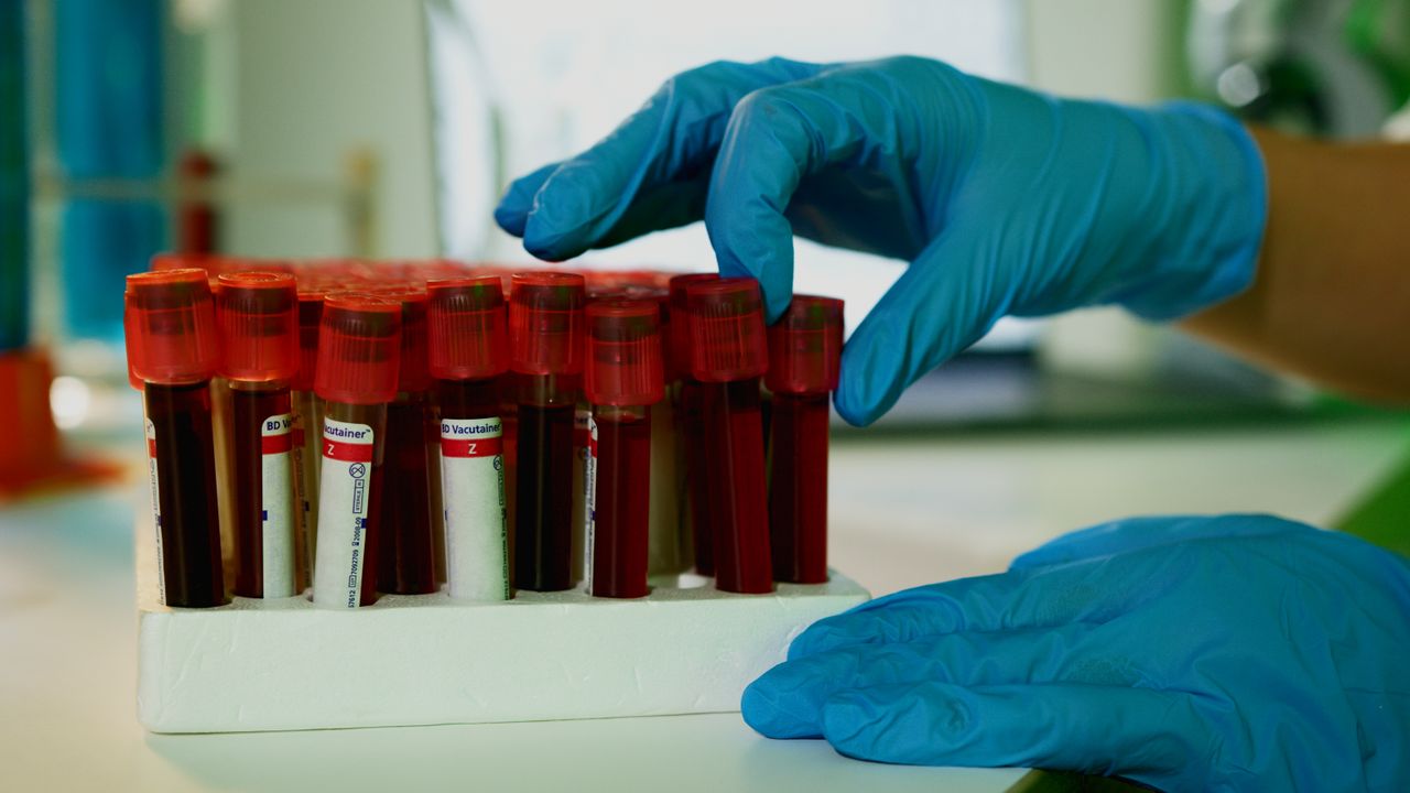 Home A lab technician handles blood vials in a laboratory setting, showcasing medical research.